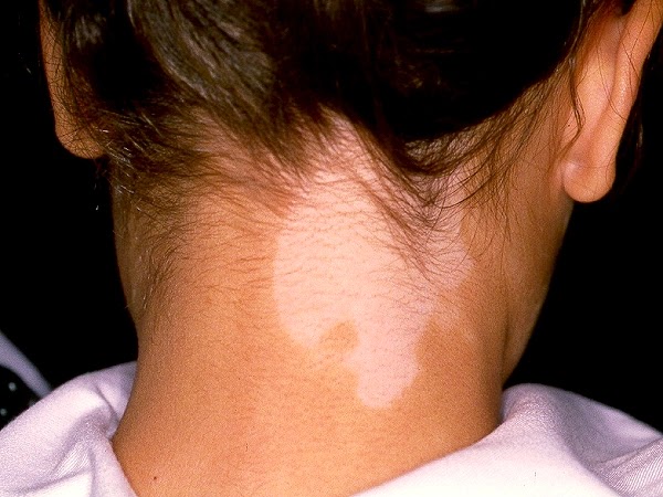 Masturba con las pecas